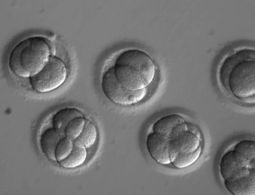 Elective Single Embryo Transfer